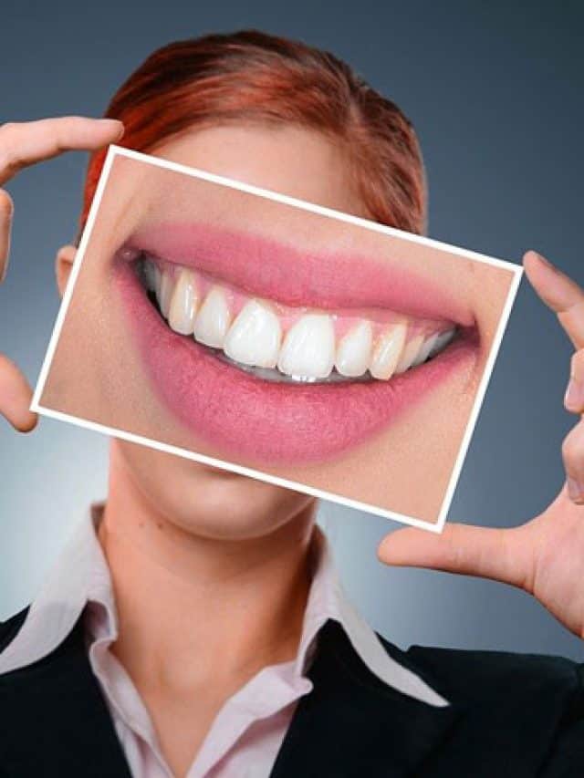 Cómo mejorar la sonrisa sin ortodoncia