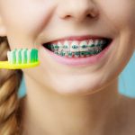 tratamiento de ortodoncia infantil