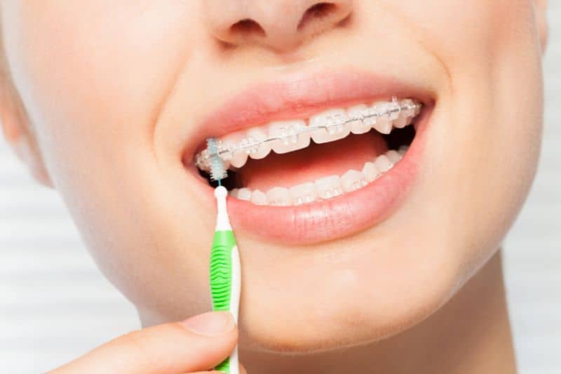 Cómo cuidar tu ortodoncia