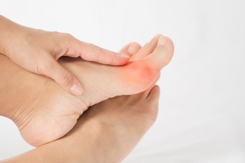 Problemas comunes en los pies